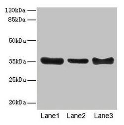 Invitrogen ZNF625 Polyclonal Antibody 100 &mu;g; Unconjugated:Antibodies,
