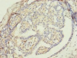 Invitrogen ZNF626 Polyclonal Antibody 100 &mu;g; Unconjugated:Antibodies,