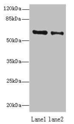 Invitrogen ZNF626 Polyclonal Antibody 100 &mu;g; Unconjugated:Antibodies,