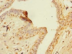 Invitrogen ZNF670 Polyclonal Antibody 100 μg; Unconjugated:Antibodies,