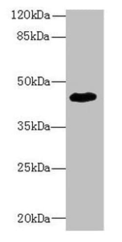Invitrogen ZNF670 Polyclonal Antibody 100 μg; Unconjugated:Antibodies,