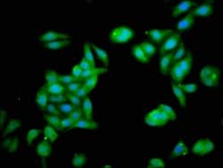 Invitrogen ZNF703 Polyclonal Antibody 100 μg; Unconjugated:Antibodies,