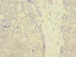 Invitrogen ZNF707 Polyclonal Antibody 100 &mu;g | Buy Online | Invitrogen&trade; | Fisher Scientific