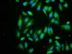 Invitrogen eIF3i Polyclonal Antibody 100 μg; Unconjugated:Antibodies,