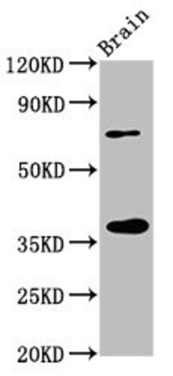 Invitrogen eIF3i Polyclonal Antibody 100 μg; Unconjugated:Antibodies,
