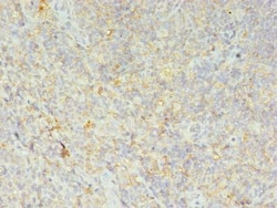 Invitrogen HLA-DRB4 Polyclonal Antibody 100 &mu;g; Unconjugated:Antibodies,