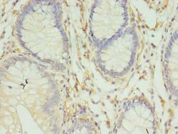 Invitrogen HLA-DRB4 Polyclonal Antibody 100 &mu;g; Unconjugated:Antibodies,