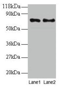 Invitrogen TAX1BP3 Polyclonal Antibody 100 &mu;g; Unconjugated:Antibodies,