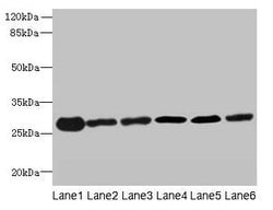 Invitrogen TMED9 Polyclonal Antibody 100 &mu;g; Unconjugated:Antibodies,