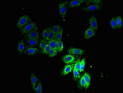 Invitrogen SCAMP3 Polyclonal Antibody 100 μg; Unconjugated:Antibodies,