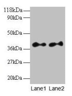 Invitrogen SCAMP3 Polyclonal Antibody 100 μg; Unconjugated:Antibodies,