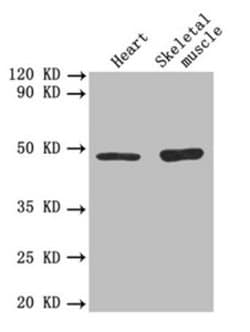 Invitrogen TGF beta-2 Polyclonal Antibody 100 &mu;g; Unconjugated:Antibodies,