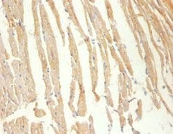 Creatine Kinase MM Polyclonal Antibody 100 &mu;g | Buy Online | Thermo Scientific | Fisher Scientific