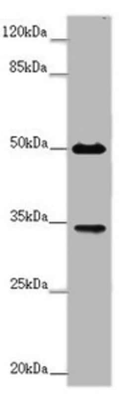 Invitrogen FCGR2B Polyclonal Antibody 100 &mu;g; Unconjugated:Antibodies,