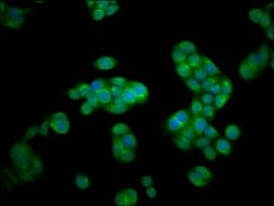 Invitrogen HEXA Polyclonal Antibody 100 μg; Unconjugated:Antibodies,