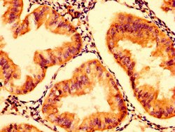 Invitrogen HEXA Polyclonal Antibody 100 μg; Unconjugated:Antibodies,