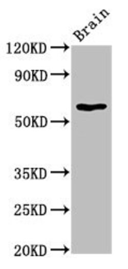 Invitrogen HEXA Polyclonal Antibody 100 μg; Unconjugated:Antibodies,