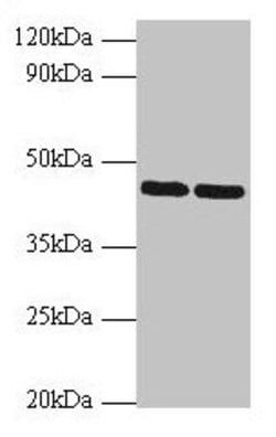 Invitrogen SHBG Polyclonal Antibody 100 μg; Unconjugated:Antibodies,