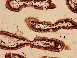 Invitrogen SAA Polyclonal Antibody 100 μg; Unconjugated:Antibodies,