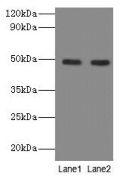 Invitrogen NEU3 Polyclonal Antibody 100 μg; Unconjugated:Antibodies,