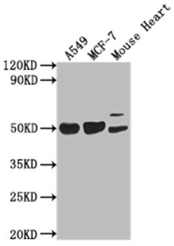 Invitrogen SRGAP2B Polyclonal Antibody 100 &mu;g; Unconjugated:Antibodies,