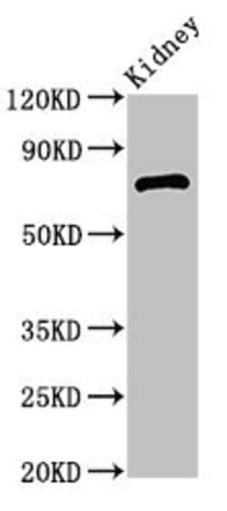 Invitrogen ZBTB16 Polyclonal Antibody 100 &mu;L; Unconjugated:Antibodies,