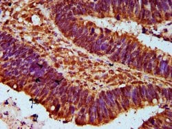 Invitrogen MTMR15 Polyclonal Antibody 100 &mu;g; Unconjugated:Antibodies,