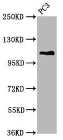 Invitrogen MTMR15 Polyclonal Antibody 100 &mu;g; Unconjugated:Antibodies,