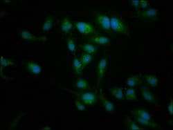 Invitrogen NT5C2 Polyclonal Antibody 100 μg; Unconjugated:Antibodies,