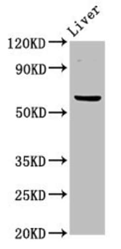 Invitrogen NT5C2 Polyclonal Antibody 100 μg; Unconjugated:Antibodies,