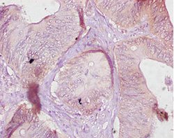 Invitrogen CES1 Polyclonal Antibody 100 &mu;g; Unconjugated:Antibodies,