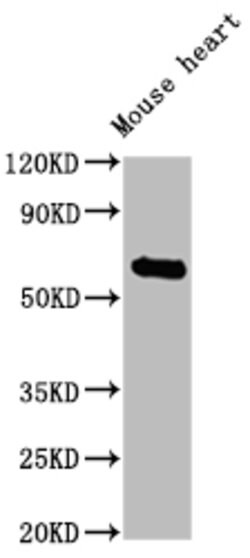 Invitrogen CES1 Polyclonal Antibody 100 &mu;g; Unconjugated:Antibodies,