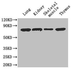 Invitrogen CES1 Polyclonal Antibody 100 &mu;g; Unconjugated:Antibodies,