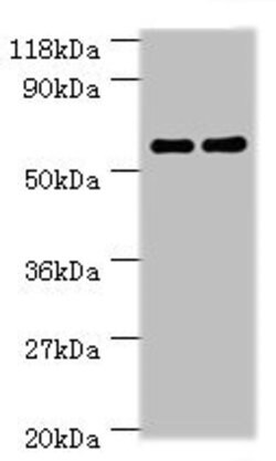 Invitrogen CES1 Polyclonal Antibody 100 &mu;g; Unconjugated:Antibodies,