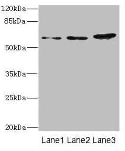 Invitrogen HERV-FRD Polyclonal Antibody 100 &mu;L | Buy Online | Invitrogen&trade; | Fisher Scientific