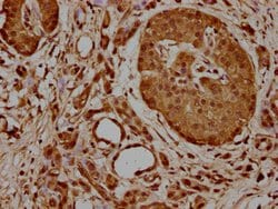 Invitrogen HSPA1A Polyclonal Antibody 100 μL; Unconjugated:Antibodies,