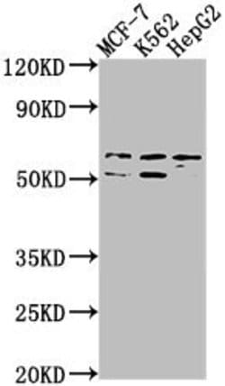 USP17L3 Polyclonal Antibody:Antibodies, Polyclonal
