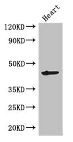 Invitrogen MEI4 Polyclonal Antibody 100 &mu;g; Unconjugated:Antibodies,