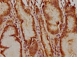 Invitrogen USP17L5 Polyclonal Antibody 100 &mu;L; Unconjugated:Antibodies,