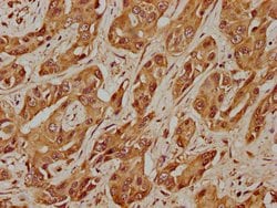 Invitrogen USP17L5 Polyclonal Antibody 100 &mu;L; Unconjugated:Antibodies,