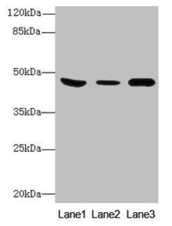Invitrogen B4GALT5 Polyclonal Antibody 100 &mu;g; Unconjugated:Antibodies,