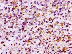 Invitrogen IL10RB Polyclonal Antibody 100 μg; Unconjugated:Antibodies,