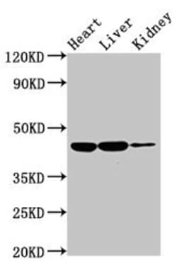 Invitrogen IL10RB Polyclonal Antibody 100 μg; Unconjugated:Antibodies,