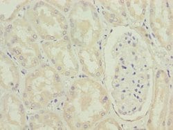 Invitrogen MRPL49 Polyclonal Antibody 100 &mu;g; Unconjugated:Antibodies,