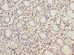 Invitrogen MRPL49 Polyclonal Antibody 100 &mu;g; Unconjugated:Antibodies,