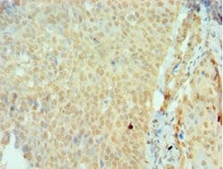 Invitrogen SSX2 Polyclonal Antibody 100 &mu;L | Buy Online | Invitrogen&trade; | Fisher Scientific