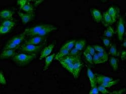 Invitrogen MAN2A1 Polyclonal Antibody 100 &mu;g; Unconjugated:Antibodies,