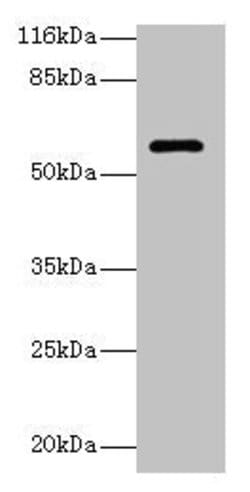 Invitrogen Glycerol kinase 3 Polyclonal Antibody 100 &mu;g | Buy Online | Invitrogen&trade; | Fisher Scientific