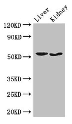 Invitrogen SNX17 Polyclonal Antibody 100 μg; Unconjugated:Antibodies,