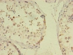 RBMY1F Polyclonal Antibody:Antibodies, Polyclonal